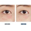 دستگاه RF شیائومی wellskins مدل WX-SP500/501 - تصویر 4